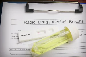 Employee Drug Tests: What You Need to Know