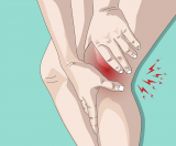 CBD Dosage for Inflammation